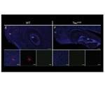 Dysfunctional neurons repaired in dementia mouse model