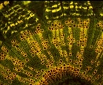 What is Reflection-contrast Microscopy?