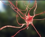 Patients with bipolar disorder are seven times more likely to develop Parkinson's