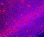 Cytoophidia Assembly, Morphology & Function