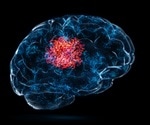 Distractions and exercise may be key to managing chronic pain