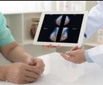 AI can predict breast cancer risk up to 5 years before diagnosis