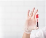New technique for separation of cancer cells enables comprehensive genetic profiling