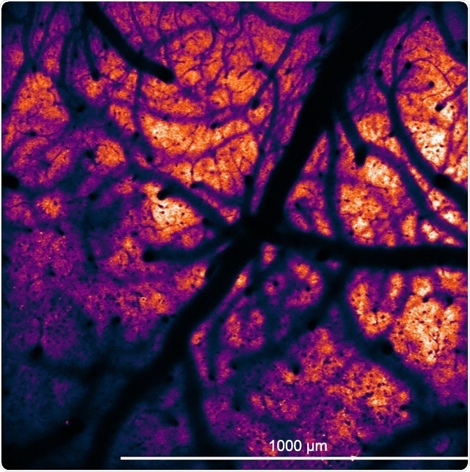 mouse neurons mouse neurons
