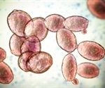 Yeast cells offer promising alternative for manufacturing DNase1