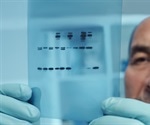 Northern Blot / RNA Blot