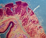 Discovery provides a potential target for infectious diseases immunotherapy