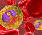 What is Churg-Strauss Syndrome?