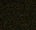 Plasmon-enhanced Fluorescence Spectroscopy