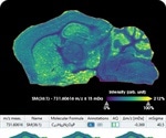Bruker launches timsTOF fleX with ESI/MALDI capability for SpatialOMx at ASMS 2019