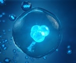 Timepoint at which B cells transform into leukemic cells impacts treatment outcomes