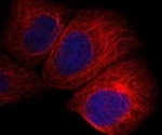 Mounting Media and Blocking Sera for Cell Imaging