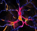 Compelling New Evidence Further Suggests Parkinson’s Disease Begins in the Gut
