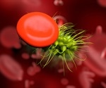 New biomarker ELL2 identified for early diagnosis and prognosis in sepsis