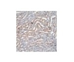 Anti-Polyethylene Glycol (PEG) RabMAb Products