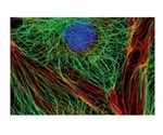 Olympus launches next-generation X Line objectives for clinical, research applications