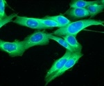 HU3DINKS project to develop human tissue-based bioinks for 3D bioprinting