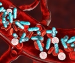 New biomarker ELL2 identified for early diagnosis and prognosis in sepsis