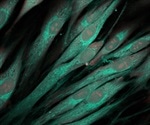 Researchers elucidate mechanisms underlying impaired ciliogenesis in PKD