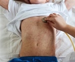 Predicting measles vaccination coverage for targeted public health action