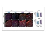 Healthy blood vessels could help stave off cognitive decline
