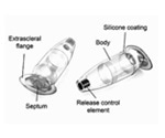 New implant technology safely minimizes injections for people with macular degeneration