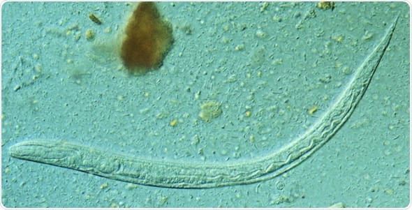 Study: Nearly one-third of Cambodians are infected with threadworm