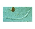 Study: Nearly one-third of Cambodians are infected with threadworm