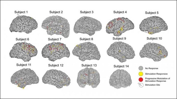 Study reveals how electrical stimulation reorganizes the brain