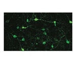 Study uncovers new hunger pathway in the brain