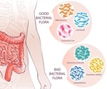 Fibromyalgia and Gut Health: SIBO and IBS