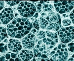 Using Light Scattering to Characterize Protein-Nucleic Acid Interactions