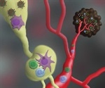 Fat cells may be egging on melanoma cells to become more aggressive