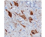An Introduction to Neurotransmission Research
