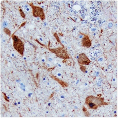 DDC in Human Brain. DDC in Human Brain.