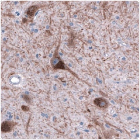DAT1 in Human Brain. DAT1 in Human Brain.
