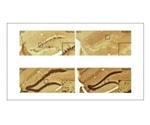 Removing newborn neurons after brain injury reduces seizures in mice