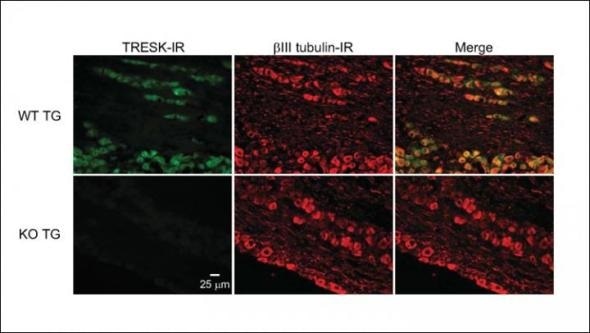 Defective potassium channels linked only with headaches, not body pain