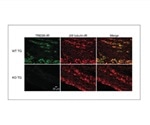 Defective potassium channels linked only with headaches, not body pain
