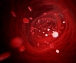 Acute Inflammation and the Leukocyte Adhesion Cascade