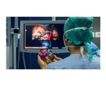 Bordeaux University Hospital uses 3D printing to improve kidney tumor removal surgery
