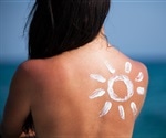 Melanoma cases climb amid declining sunscreen use in Canada