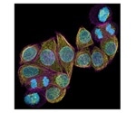 New Multiplex mode for ZEISS Airyscan 2 delivers images with superresolution in less time