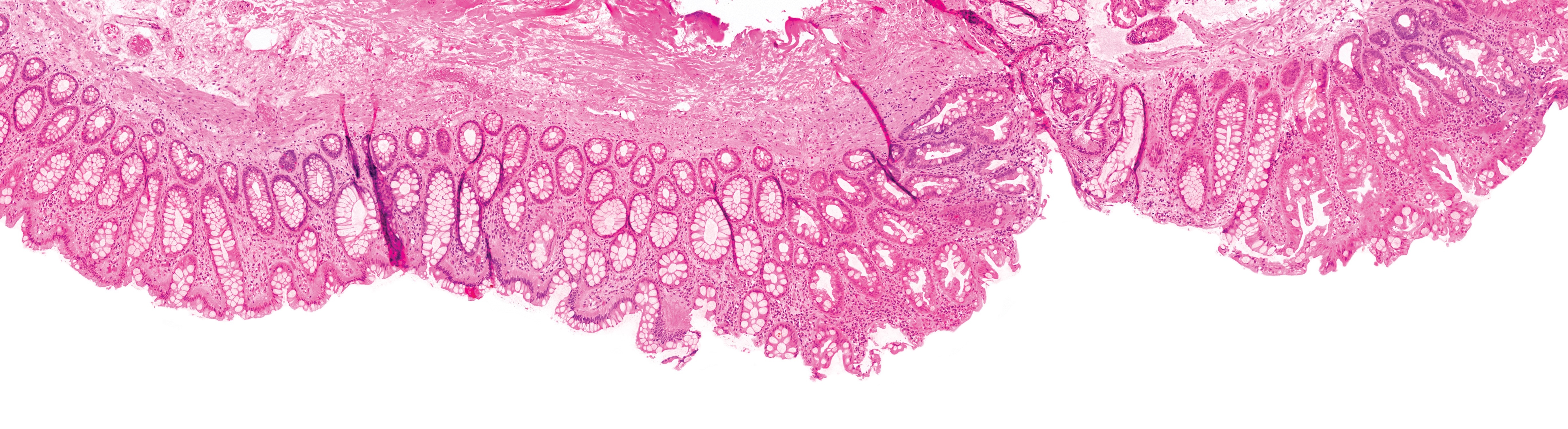 Tissue sample