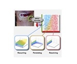 Mathematical model helps identify determinants of persistent MRSA bacteremia