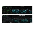 Retina can restructure itself following gene therapy