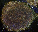Induced Pluripotent Stem (iPS) Cells in Medicine and Research