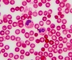 Cell Counting Without Slides to Reduce Waste and Cost
