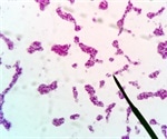 Botulism Treatment and Prevention