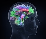 Don't Miss the Blood-Brain Barrier Drug Delivery (B3DD) Summit this August